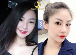 Thu gon canh mui 4